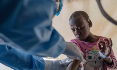 Congo Reports Over A Thousand Mpox Cases In A Week