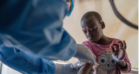 Congo Reports Over A Thousand Mpox Cases In A Week